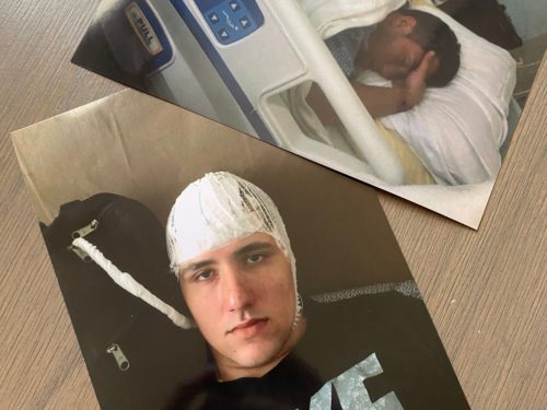 Nicholas Mauricio shares pictures of himself after experiencing a traumatic brain injury stemming from a fraternity hazing incident. He spent five days in an intensive care unit. Photo credit: Mauricio family